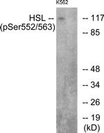 Phospho-HSL (Ser552) Antibody in Western Blot (WB)