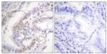 Phospho-Ku70 (Ser5) Antibody in Immunohistochemistry (Paraffin) (IHC (P))