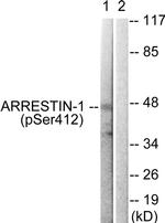 Phospho-beta Arrestin 1 (Ser412) Antibody in Western Blot (WB)