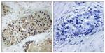 Phospho-Artemis (Ser516) Antibody in Immunohistochemistry (Paraffin) (IHC (P))
