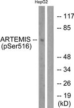 Phospho-Artemis (Ser516) Antibody in Western Blot (WB)