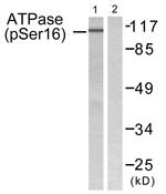 Phospho-ATP1A1 (Ser16) Antibody in Western Blot (WB)