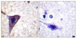 Phospho-BID (Ser78) Antibody in Immunohistochemistry (Paraffin) (IHC (P))