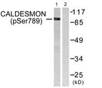 Phospho-Caldesmon (Ser789) Antibody in Western Blot (WB)