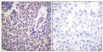 Phospho-Calnexin (Ser583) Antibody in Immunohistochemistry (Paraffin) (IHC (P))