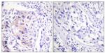 Phospho-c-Cbl (Tyr774) Antibody in Immunohistochemistry (Paraffin) (IHC (P))