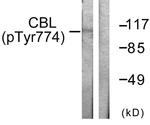Phospho-c-Cbl (Tyr774) Antibody in Western Blot (WB)