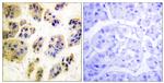 Phospho-c-Cbl (Tyr700) Antibody in Immunohistochemistry (Paraffin) (IHC (P))