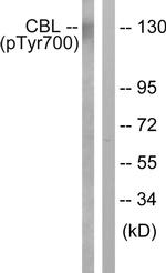 Phospho-c-Cbl (Tyr700) Antibody in Western Blot (WB)