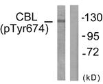 Phospho-c-Cbl (Tyr674) Antibody in Western Blot (WB)
