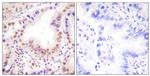 ETS1 Antibody in Immunohistochemistry (Paraffin) (IHC (P))