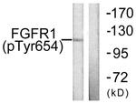 Phospho-FGFR1 (Tyr654) Antibody in Western Blot (WB)