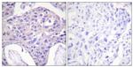 FOXO1/FOXO3/FOXO4 Antibody in Immunohistochemistry (Paraffin) (IHC (P))