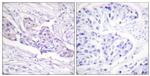 Phospho-FOXO1 (Ser329) Antibody in Immunohistochemistry (Paraffin) (IHC (P))