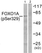 Phospho-FOXO1 (Ser329) Antibody in Western Blot (WB)