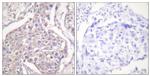 Phospho-HSP20 (Ser16) Antibody in Immunohistochemistry (Paraffin) (IHC (P))