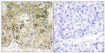 Phospho-ITGB1 (Thr789) Antibody in Immunohistochemistry (Paraffin) (IHC (P))