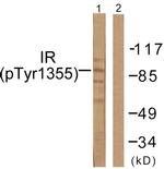 Phospho-INSR (Tyr1355) Antibody in Western Blot (WB)
