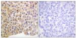 Phospho-INSR (Tyr1361) Antibody in Immunohistochemistry (Paraffin) (IHC (P))