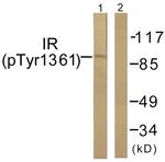 Phospho-INSR (Tyr1361) Antibody in Western Blot (WB)