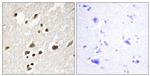 Phospho-IRF3 (Ser385) Antibody in Immunohistochemistry (Paraffin) (IHC (P))