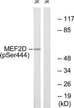Phospho-MEF2D (Ser444) Antibody in Western Blot (WB)