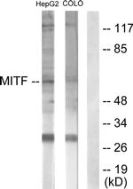 MiTF Antibody in Western Blot (WB)
