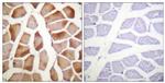 MRLC2 Antibody in Immunohistochemistry (Paraffin) (IHC (P))