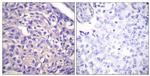 MYPT1 Antibody in Immunohistochemistry (Paraffin) (IHC (P))