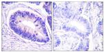Phospho-MYPT1 (Thr853) Antibody in Immunohistochemistry (Paraffin) (IHC (P))