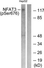 Phospho-NFATC4 (Ser676) Antibody in Western Blot (WB)