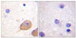 Phospho-nNOS (Ser852) Antibody in Immunohistochemistry (Paraffin) (IHC (P))
