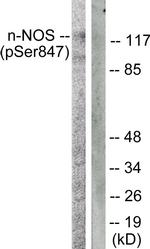 Phospho-nNOS (Ser852) Antibody in Western Blot (WB)