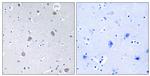 Phospho-p70 S6 Kinase (Ser371) Antibody in Immunohistochemistry (Paraffin) (IHC (P))