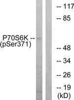 Phospho-p70 S6 Kinase (Ser371) Antibody in Western Blot (WB)