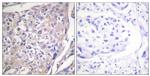 Phospho-p70 S6 Kinase (Ser418) Antibody in Immunohistochemistry (Paraffin) (IHC (P))