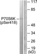 Phospho-p70 S6 Kinase (Ser418) Antibody in Western Blot (WB)