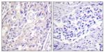 Phospho-RSK1 (Thr359, Ser363) Antibody in Immunohistochemistry (Paraffin) (IHC (P))
