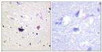 PAK1/2/3 Antibody in Immunohistochemistry (Paraffin) (IHC (P))