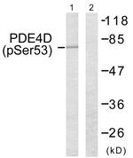 Phospho-PDE4D (Ser53, Ser190) Antibody in Western Blot (WB)