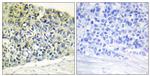Phospho-PEA15 (Ser116) Antibody in Immunohistochemistry (Paraffin) (IHC (P))