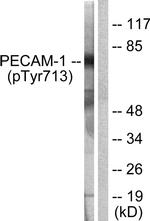 Phospho-CD31 (Tyr713) Antibody in Western Blot (WB)