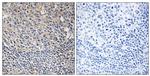 Phospho-PLCG2 (Tyr1217) Antibody in Immunohistochemistry (Paraffin) (IHC (P))