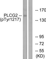 Phospho-PLCG2 (Tyr1217) Antibody in Western Blot (WB)