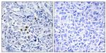 Phospho-PLK1 (Thr210) Antibody in Immunohistochemistry (Paraffin) (IHC (P))
