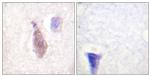 Phospho-RPH3A (Ser237) Antibody in Immunohistochemistry (Paraffin) (IHC (P))