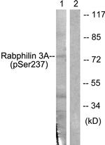 Phospho-RPH3A (Ser237) Antibody in Western Blot (WB)