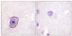 Phospho-Rhodopsin (Ser334) Antibody in Immunohistochemistry (Paraffin) (IHC (P))