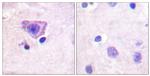 Phospho-RyR2 (Ser2808) Antibody in Immunohistochemistry (Paraffin) (IHC (P))