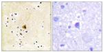 RyR2 Antibody in Immunohistochemistry (Paraffin) (IHC (P))